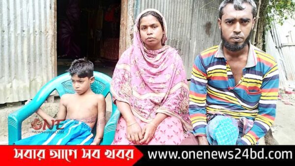 টাকার অভাবে পঙ্গু হতে হচ্ছে স্কুল পড়ুয়া আজিমের 