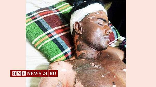 বিদ্যুৎস্পৃষ্ট হয়ে গুরুত্ব আহত পল্লী বিদ্যুৎ কর্মী