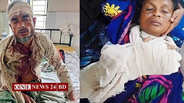 হোসেনপুরে স্বামী-স্ত্রীকে কুপিয়ে লুটপাটের অভিযোগ