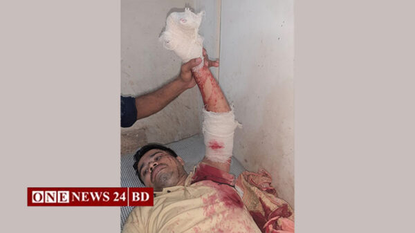 পাকুন্দিয়ায় যুবককে কুপিয়ে জখম