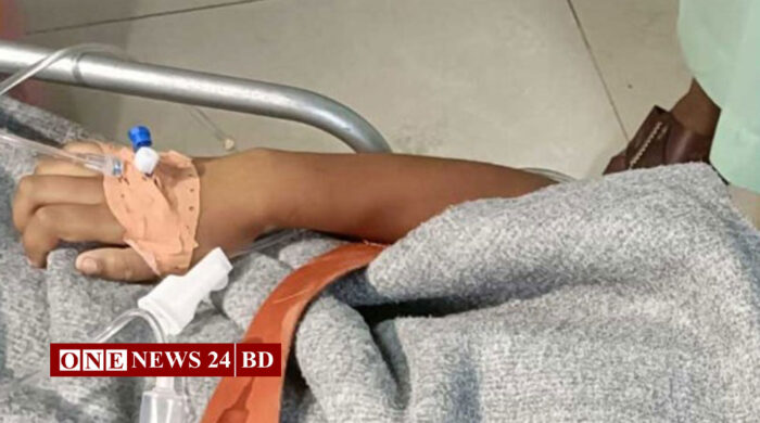 টেকনাফের শিশুটি আইসিইউতে