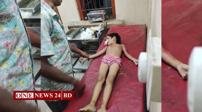 পাকুন্দিয়ায় অটোবাইকের চাপায় ৬ বছরের শিশু নিহত